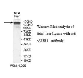 AP3B1 Antibody from Signalway Antibody (39923) - Antibodies.com
