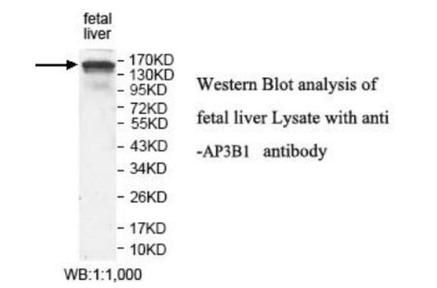 AP3B1 Antibody from Signalway Antibody (39923) - Antibodies.com