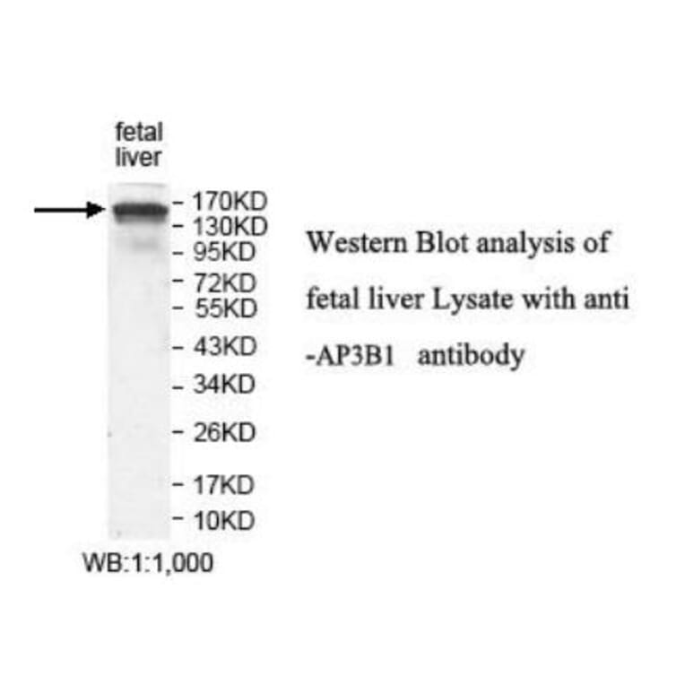 AP3B1 Antibody from Signalway Antibody (39923) - Antibodies.com