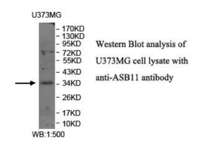 ASB11 Antibody from Signalway Antibody (39941) - Antibodies.com