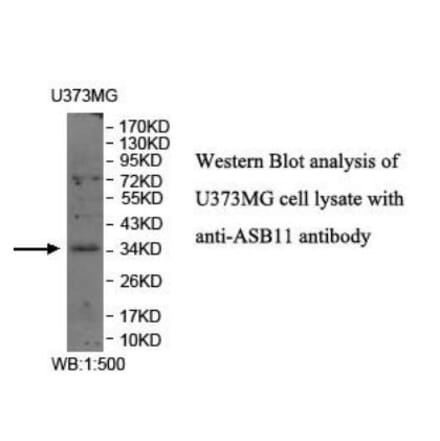 ASB11 Antibody from Signalway Antibody (39941) - Antibodies.com