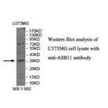 ASB11 Antibody from Signalway Antibody (39941) - Antibodies.com