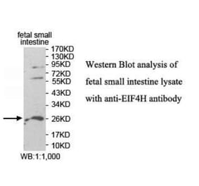 EIF4H Antibody from Signalway Antibody (39943) - Antibodies.com