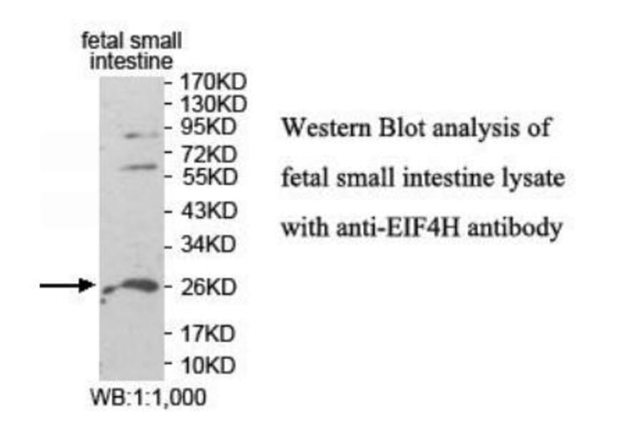 EIF4H Antibody from Signalway Antibody (39943) - Antibodies.com