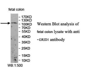 GRID1 Antibody from Signalway Antibody (39955) - Antibodies.com