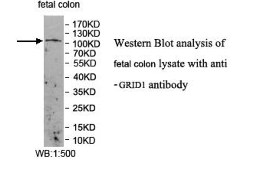 GRID1 Antibody from Signalway Antibody (39955) - Antibodies.com