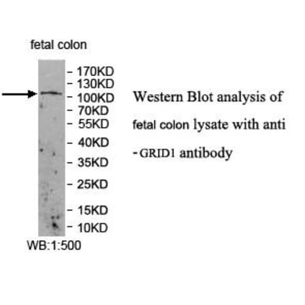 GRID1 Antibody from Signalway Antibody (39955) - Antibodies.com