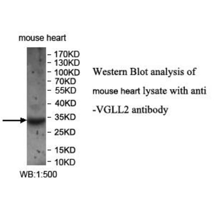 VGLL2 Antibody from Signalway Antibody (39962) - Antibodies.com