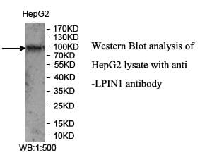 Anti-LPIN1 Antibody