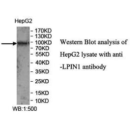 LPIN1 Antibody from Signalway Antibody (39971) - Antibodies.com