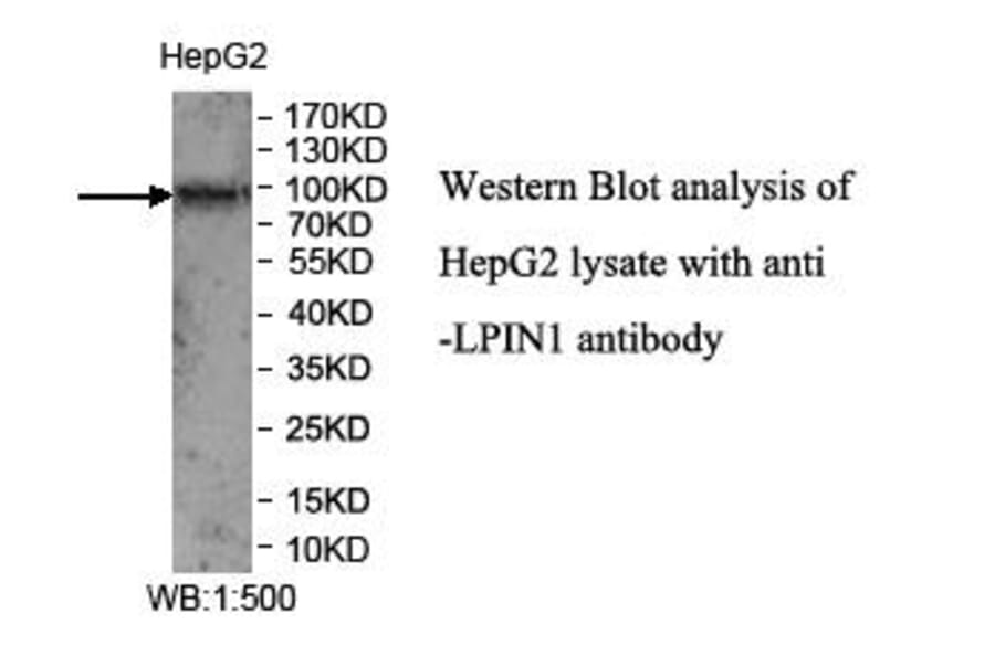 LPIN1 Antibody from Signalway Antibody (39971) - Antibodies.com