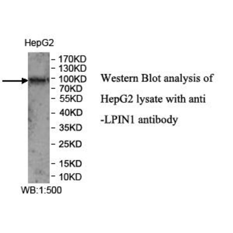LPIN1 Antibody from Signalway Antibody (39971) - Antibodies.com