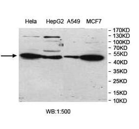 UBOX5 Antibody from Signalway Antibody (39976) - Antibodies.com