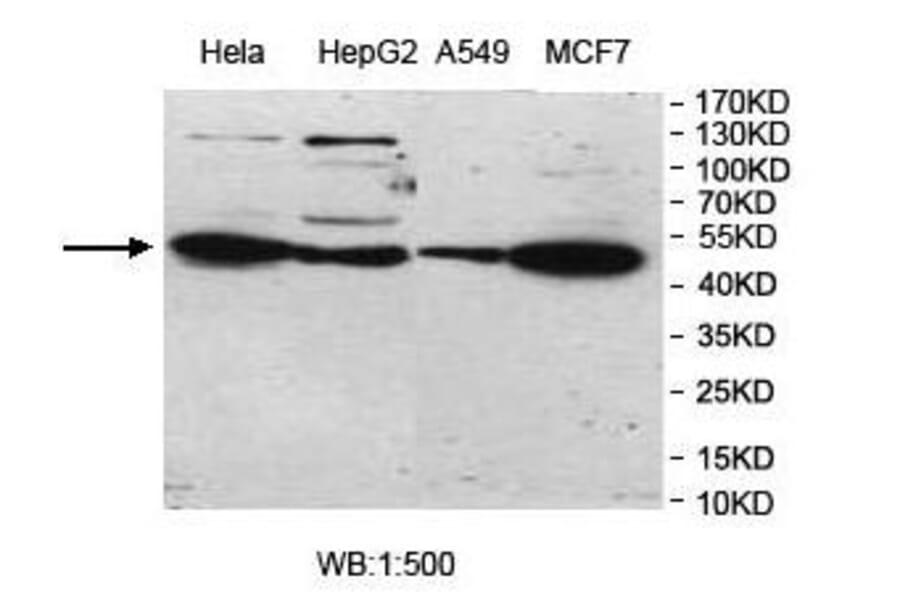 UBOX5 Antibody from Signalway Antibody (39976) - Antibodies.com