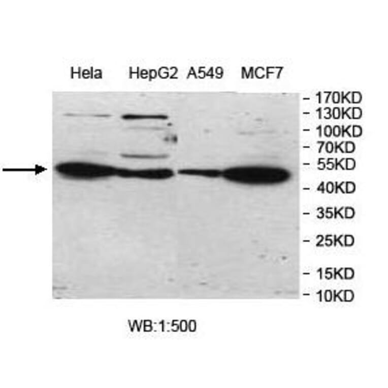 UBOX5 Antibody from Signalway Antibody (39976) - Antibodies.com