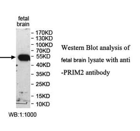 PRIM2 Antibody from Signalway Antibody (39993) - Antibodies.com