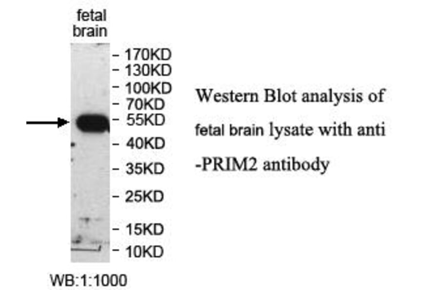 PRIM2 Antibody from Signalway Antibody (39993) - Antibodies.com