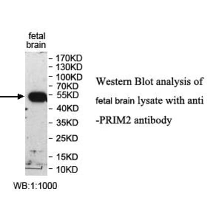 PRIM2 Antibody from Signalway Antibody (39993) - Antibodies.com