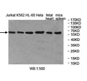 MOCS1 Antibody from Signalway Antibody (40001) - Antibodies.com