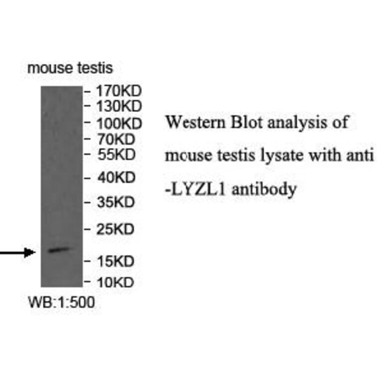 LYZL1 Antibody from Signalway Antibody (40002) - Antibodies.com