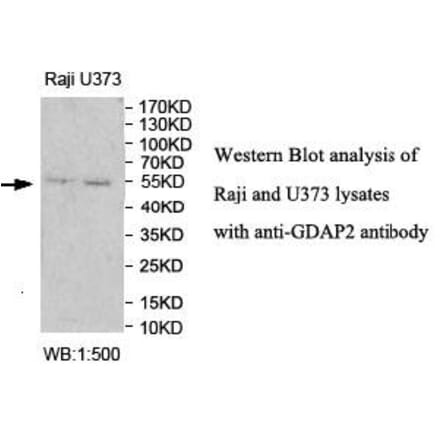 GDAP2 Antibody from Signalway Antibody (40003) - Antibodies.com