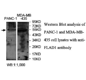 FLAD1 Antibody from Signalway Antibody (40037) - Antibodies.com