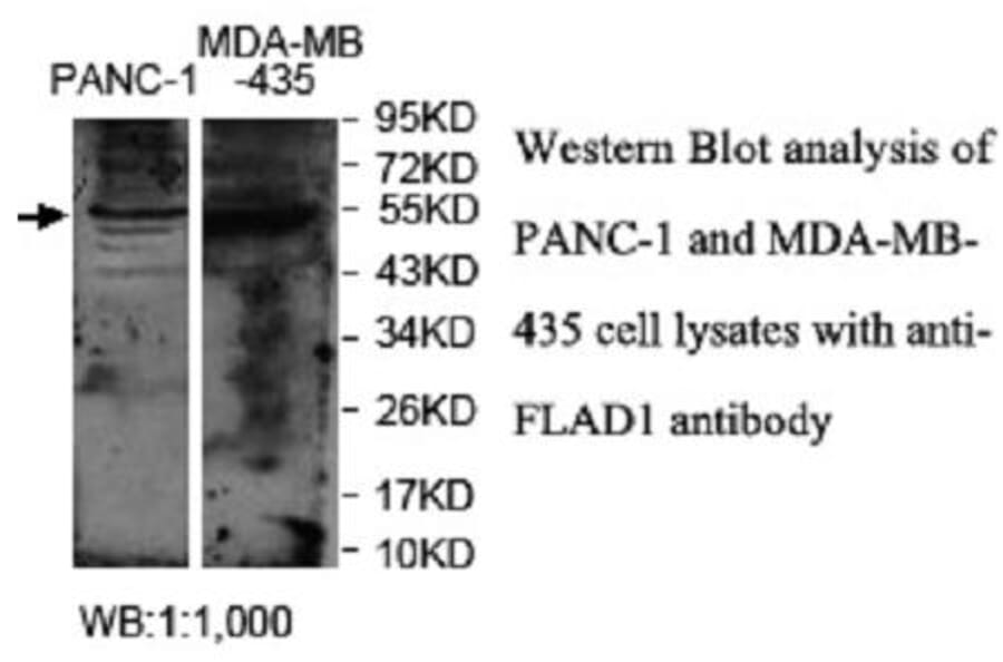 FLAD1 Antibody from Signalway Antibody (40037) - Antibodies.com