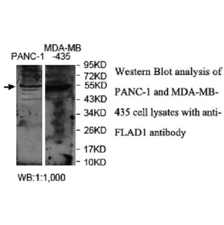 FLAD1 Antibody from Signalway Antibody (40037) - Antibodies.com