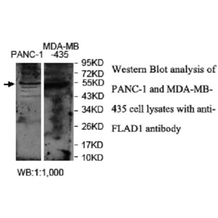 FLAD1 Antibody from Signalway Antibody (40037) - Antibodies.com