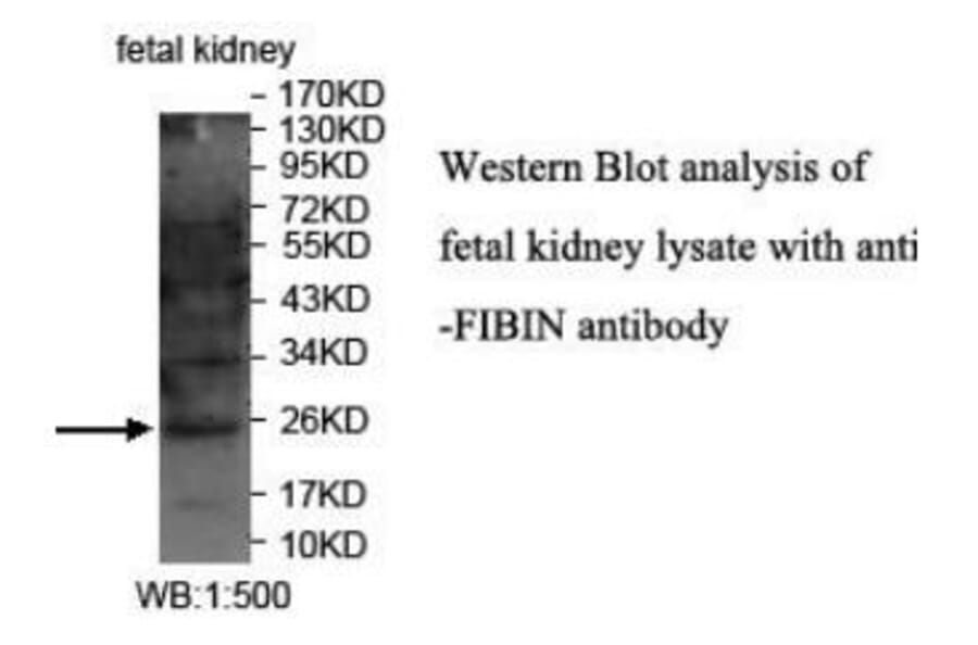 FIBIN Antibody from Signalway Antibody (40040) - Antibodies.com