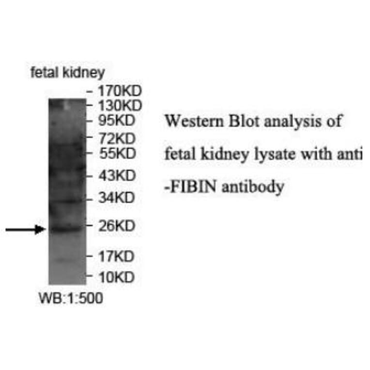 FIBIN Antibody from Signalway Antibody (40040) - Antibodies.com