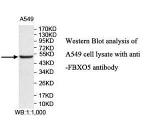 FBXO5 Antibody from Signalway Antibody (40044) - Antibodies.com