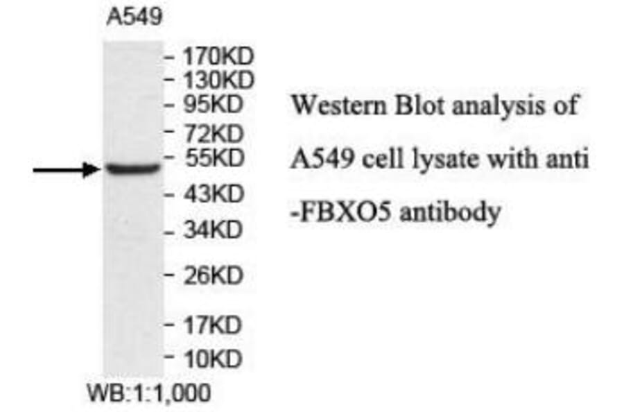 FBXO5 Antibody from Signalway Antibody (40044) - Antibodies.com