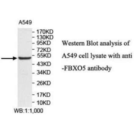 FBXO5 Antibody from Signalway Antibody (40044) - Antibodies.com