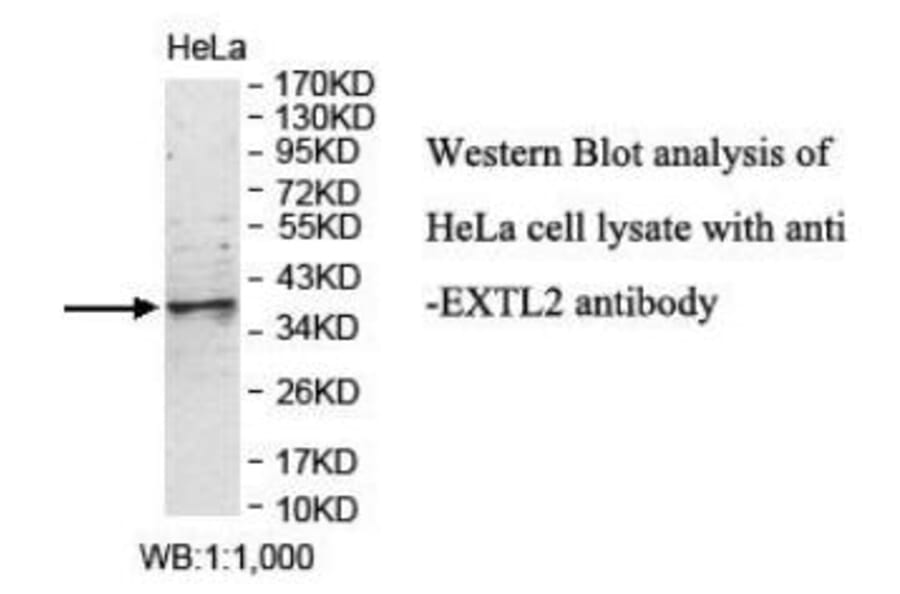 EXTL2 Antibody from Signalway Antibody (40049) - Antibodies.com