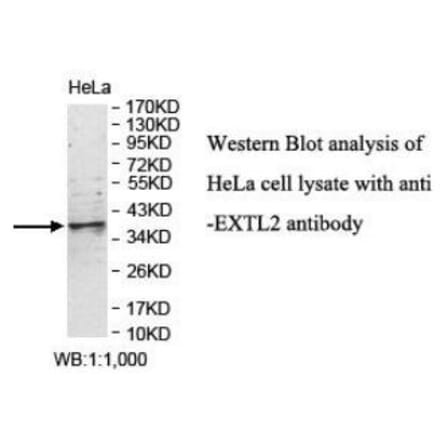 EXTL2 Antibody from Signalway Antibody (40049) - Antibodies.com