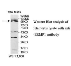 ERMP1 Antibody from Signalway Antibody (40050) - Antibodies.com
