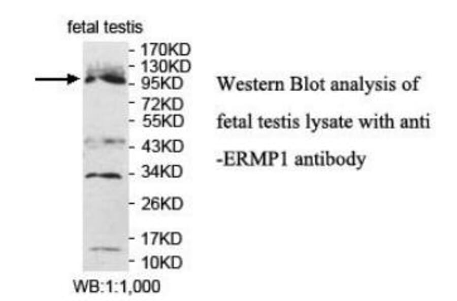 ERMP1 Antibody from Signalway Antibody (40050) - Antibodies.com