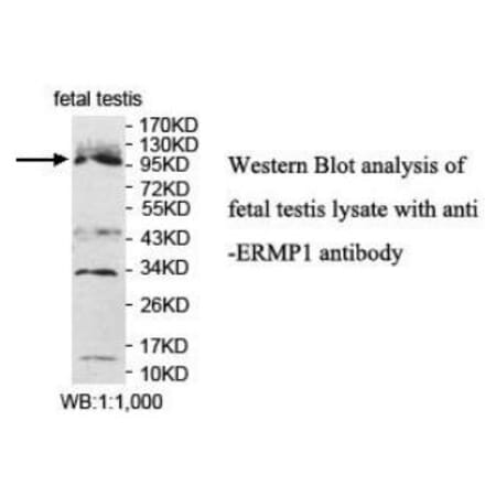 ERMP1 Antibody from Signalway Antibody (40050) - Antibodies.com