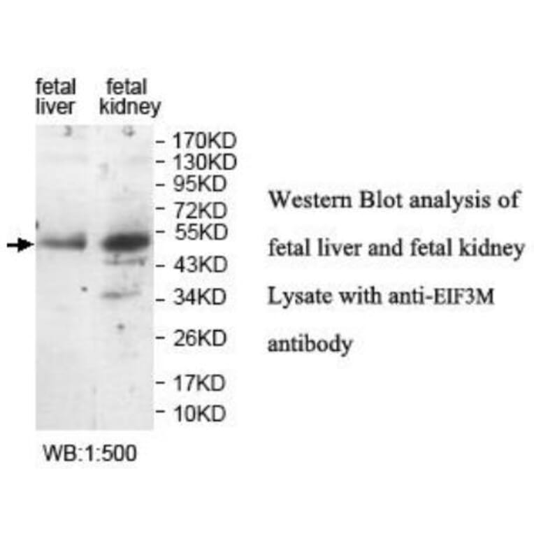 EIF3M Antibody from Signalway Antibody (40052) - Antibodies.com