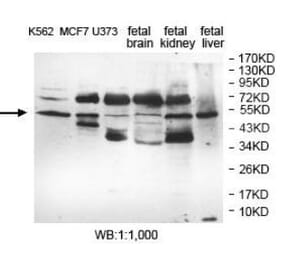 EFHA1 Antibody from Signalway Antibody (40054) - Antibodies.com