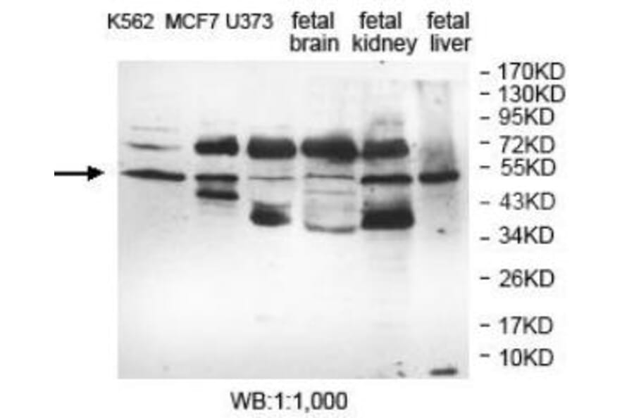 EFHA1 Antibody from Signalway Antibody (40054) - Antibodies.com