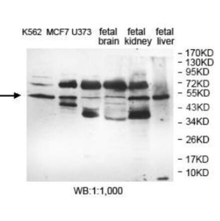 EFHA1 Antibody from Signalway Antibody (40054) - Antibodies.com