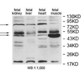 EDEM2 Antibody from Signalway Antibody (40055) - Antibodies.com