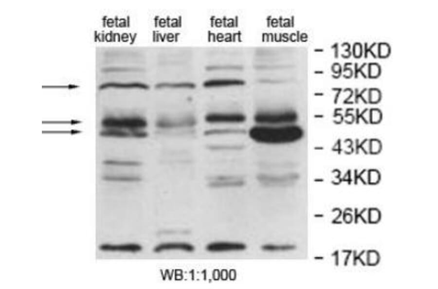 EDEM2 Antibody from Signalway Antibody (40055) - Antibodies.com