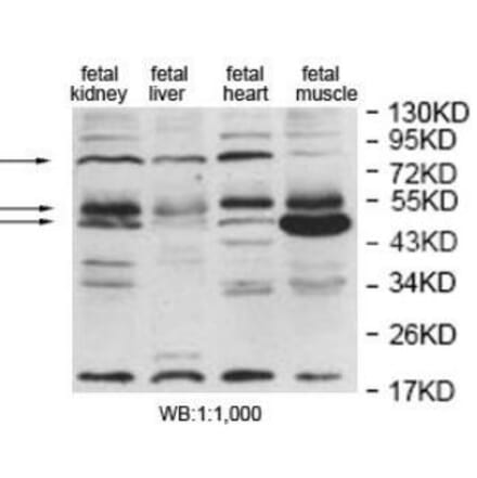 EDEM2 Antibody from Signalway Antibody (40055) - Antibodies.com