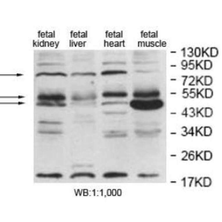 EDEM2 Antibody from Signalway Antibody (40055) - Antibodies.com