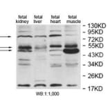 EDEM2 Antibody from Signalway Antibody (40055) - Antibodies.com