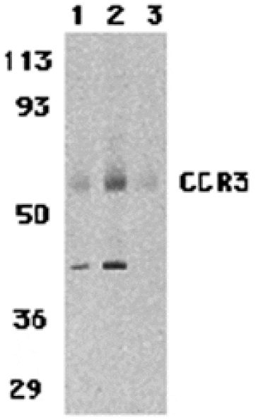 Western blot - CCR3 Antibody from Signalway Antibody (24007) - Antibodies.com