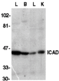 Western blot - ICAD Antibody from Signalway Antibody (24036) - Antibodies.com